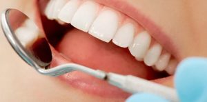 Современная эстетическая стоматология: протезирование зубов