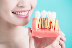 Протезирование зубов любой сложности в стоматологии на Парковой