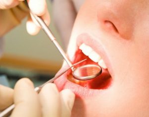 Рекомендации по лечению зубов
