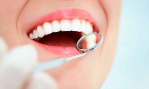 Имплантация зубов по стоматологической технологии аll-on-4